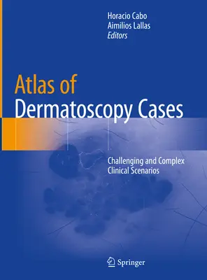 Atlas przypadków dermatoskopii: Trudne i złożone scenariusze kliniczne - Atlas of Dermatoscopy Cases: Challenging and Complex Clinical Scenarios