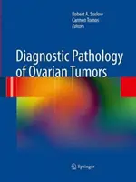 Patologia diagnostyczna guzów jajnika - Diagnostic Pathology of Ovarian Tumors