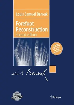 Rekonstrukcja przodostopia - Forefoot Reconstruction