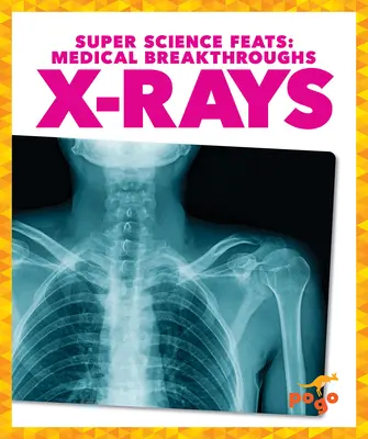 Promienie X - X-Rays