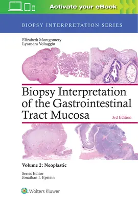 Interpretacja biopsji błony śluzowej przewodu pokarmowego: Tom 2: Nowotwory - Biopsy Interpretation of the Gastrointestinal Tract Mucosa: Volume 2: Neoplastic