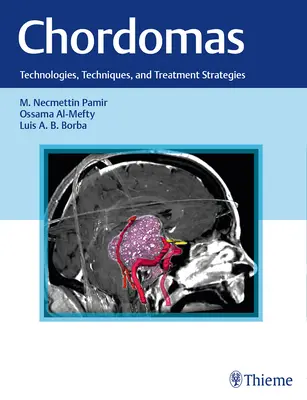 Chordomas: Technologie, techniki i strategie leczenia - Chordomas: Technologies, Techniques, and Treatment Strategies