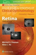 Siatkówka oka - Retina