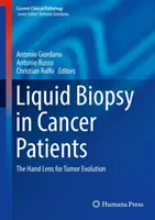 Płynna biopsja u pacjentów z nowotworami: Ręczny obiektyw do ewolucji nowotworów - Liquid Biopsy in Cancer Patients: The Hand Lens for Tumor Evolution