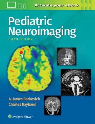 Neuroobrazowanie pediatryczne - Pediatric Neuroimaging