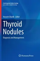 Guzki tarczycy: Diagnoza i zarządzanie - Thyroid Nodules: Diagnosis and Management