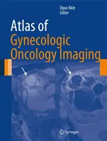 Atlas obrazowania w onkologii ginekologicznej - Atlas of Gynecologic Oncology Imaging