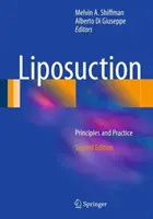 Liposukcja: Zasady i praktyka - Liposuction: Principles and Practice