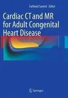 Tomografia komputerowa i rezonans magnetyczny serca u dorosłych z wrodzonymi wadami serca - Cardiac CT and MR for Adult Congenital Heart Disease