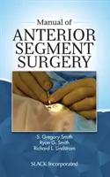 Podręcznik chirurgii przedniego odcinka oka - Manual of Anterior Segment Surgery