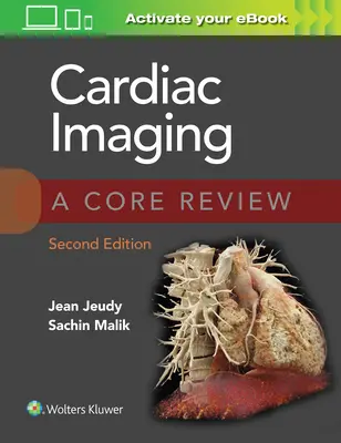 Obrazowanie serca: Przegląd podstawowy - Cardiac Imaging: A Core Review