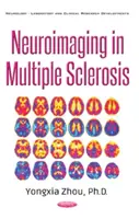 Neuroobrazowanie w stwardnieniu rozsianym - Neuroimaging in Multiple Sclerosis