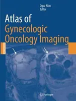 Atlas obrazowania w onkologii ginekologicznej - Atlas of Gynecologic Oncology Imaging