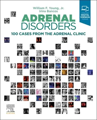 Zaburzenia nadnerczy: 100 przypadków z kliniki nadnerczy - Adrenal Disorders: 100 Cases from the Adrenal Clinic