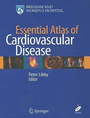 Niezbędny atlas chorób układu krążenia [z CDROM] - Essential Atlas of Cardiovascular Disease [With CDROM]