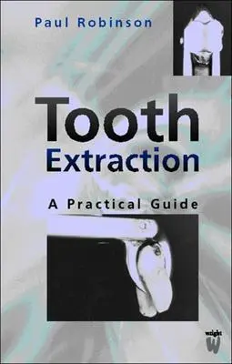 Ekstrakcja zęba: Praktyczny przewodnik - Tooth Extraction: A Practical Guide