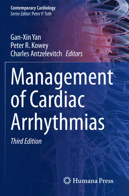 Postępowanie w przypadku arytmii serca - Management of Cardiac Arrhythmias