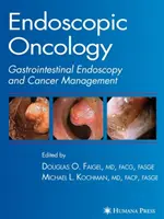 Onkologia endoskopowa - Endoscopic Oncology