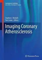 Obrazowanie miażdżycy naczyń wieńcowych - Imaging Coronary Atherosclerosis