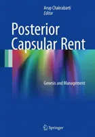 Wypożyczalnia torebek tylnych: geneza i zarządzanie - Posterior Capsular Rent: Genesis and Management