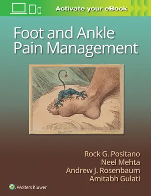 Leczenie bólu stopy i stawu skokowego - Foot and Ankle Pain Management