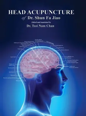 Akupunktura głowy dr Shun Fa Jiao - Head Acupuncture of Dr. Shun Fa Jiao