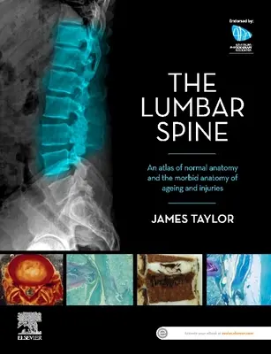 Kręgosłup lędźwiowy: Atlas anatomii prawidłowej oraz anatomii chorobowej związanej ze starzeniem się i urazami - The Lumbar Spine: An Atlas of Normal Anatomy and the Morbid Anatomy of Ageing and Injury