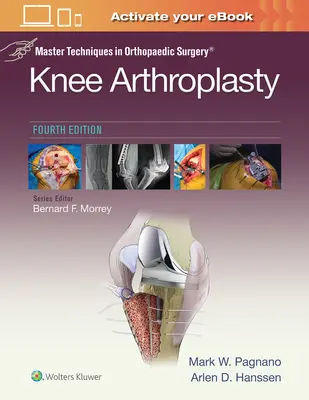 Mistrzowskie techniki w chirurgii ortopedycznej: Artroplastyka stawu kolanowego - Master Techniques in Orthopedic Surgery: Knee Arthroplasty
