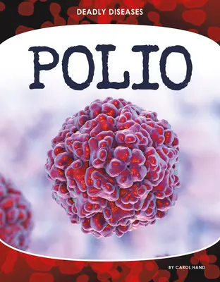 Polio