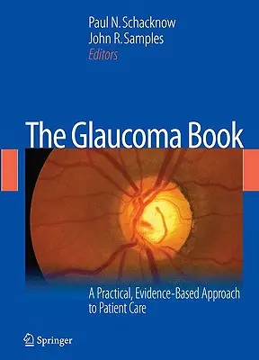 The Glaucoma Book: Praktyczne, oparte na dowodach podejście do opieki nad pacjentem - The Glaucoma Book: A Practical, Evidence-Based Approach to Patient Care