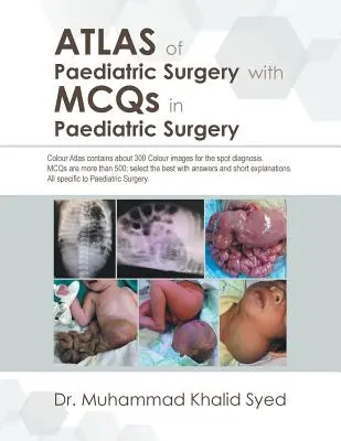 Atlas chirurgii dziecięcej z pytaniami wielokrotnego wyboru w chirurgii dziecięcej - Atlas of Paediatric Surgery with Mcqs in Paediatric Surgery