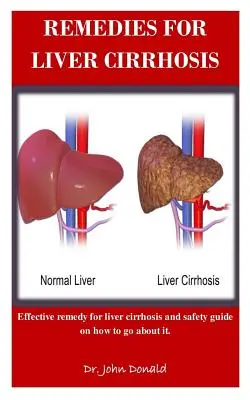 Środki zaradcze na marskość wątroby: Skuteczne leki na marskość wątroby i przewodnik bezpieczeństwa, jak sobie z tym poradzić - Remedies For Liver Cirrhosis: Effective remedies for liver cirrhosis and safety guide on how to go about it