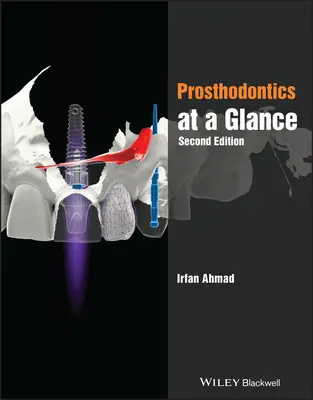 Protetyka w skrócie - Prosthodontics at a Glance