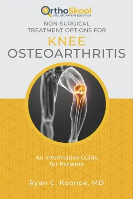 Niechirurgiczne opcje leczenia choroby zwyrodnieniowej stawu kolanowego: Informacyjny przewodnik dla pacjentów - Non-Surgical Treatment Options for Knee Osteoarthritis: An Informative Guide for Patients