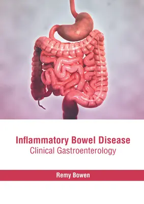 Choroba zapalna jelit: Gastroenterologia kliniczna - Inflammatory Bowel Disease: Clinical Gastroenterology