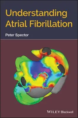 Zrozumieć migotanie przedsionków - Understanding Atrial Fibrillation