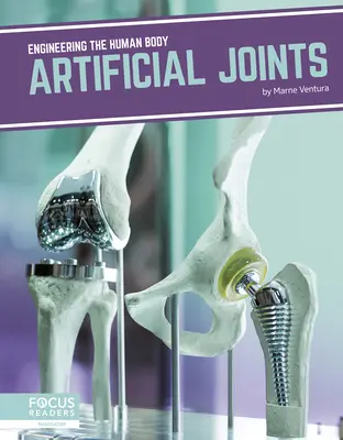 Sztuczne stawy - Artificial Joints