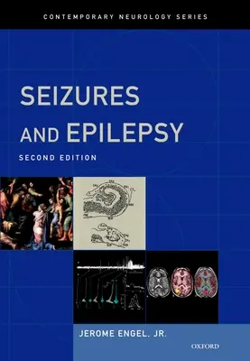 Napady padaczkowe i epilepsja - Seizures and Epilepsy
