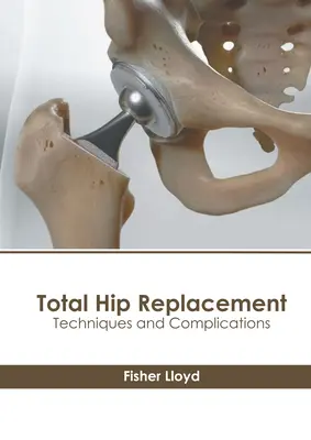 Całkowita wymiana stawu biodrowego: Techniki i powikłania - Total Hip Replacement: Techniques and Complications