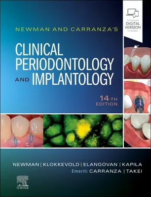 Periodontologia kliniczna i implantologia Newmana i Carranzy - Newman and Carranza's Clinical Periodontology and Implantology