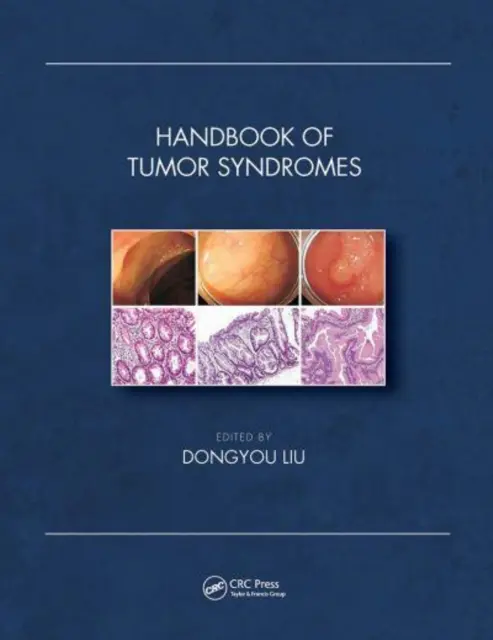 Podręcznik zespołów nowotworowych - Handbook of Tumor Syndromes