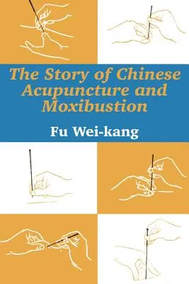 Historia chińskiej akupunktury i moksybustii - The Story of Chinese Acupuncture and Moxibustion