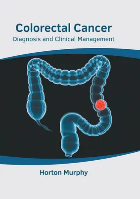 Rak jelita grubego: Diagnoza i postępowanie kliniczne - Colorectal Cancer: Diagnosis and Clinical Management