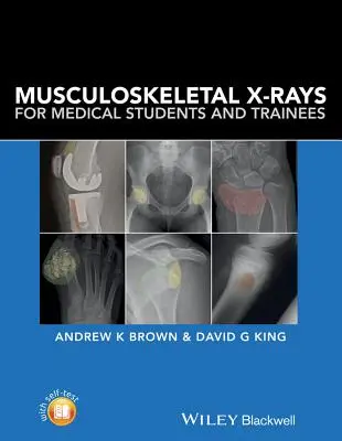 Zdjęcia rentgenowskie układu mięśniowo-szkieletowego dla studentów medycyny i stażystów - Musculoskeletal X-Rays for Medical Students and Trainees