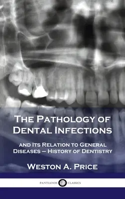 Patologia zakażeń zębów i jej związek z chorobami ogólnymi - historia stomatologii - Pathology of Dental Infections: and Its Relation to General Diseases - History of Dentistry