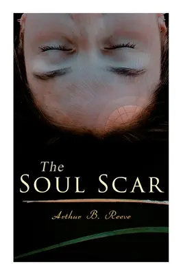 Blizna na duszy: Sprawa detektywa Craiga Kennedy'ego - The Soul Scar: Detective Craig Kennedy's Case