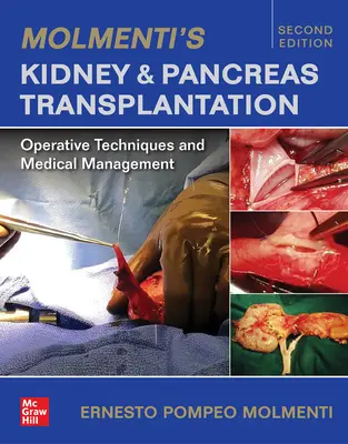 Molmenti's Kidney and Pancreas Transplantation: Techniki operacyjne i postępowanie medyczne - Molmenti's Kidney and Pancreas Transplantation: Operative Techniques and Medical Management