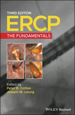 Ercp: Podstawy - Ercp: The Fundamentals