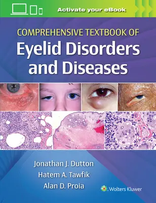 Kompleksowy podręcznik zaburzeń i chorób powiek - Comprehensive Textbook of Eyelid Disorders and Diseases