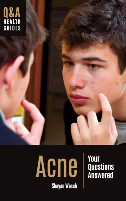 Trądzik: odpowiedzi na pytania - Acne: Your Questions Answered